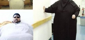 السمنة في المملكة.. من ظاهرة إلى كارثة